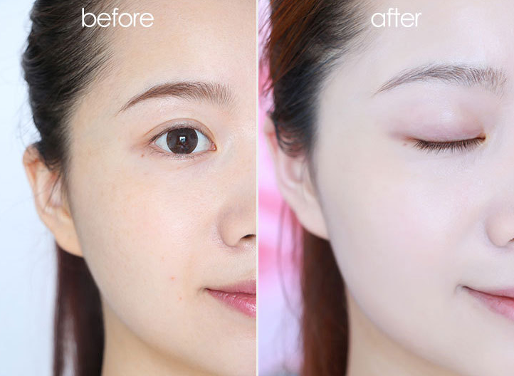 Whitening Freckle cream